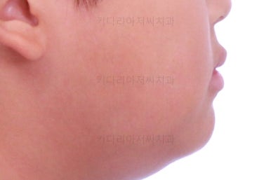 부산어린이교정