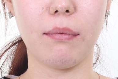 연산동교정치과