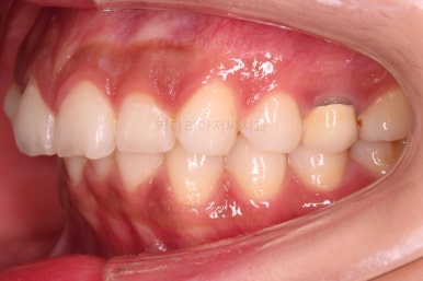 연산동교정치과