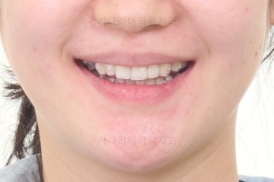 부산인비절라인