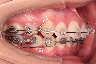 연산동치아교정치과