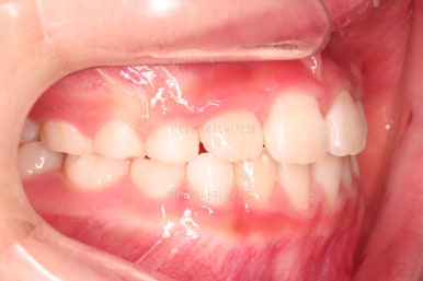 부산어린이교정