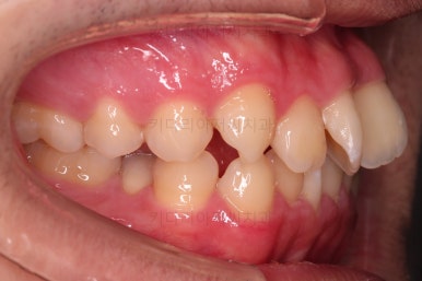 부산교정치과추천