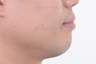 부산교정치과추천