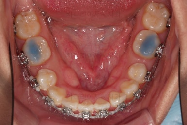 연산동치아교정치과