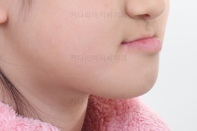 부산어린이교정