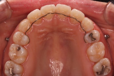 부산연산동교정치과