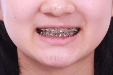 부산청소년교정치과