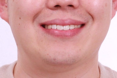 부산인비절라인