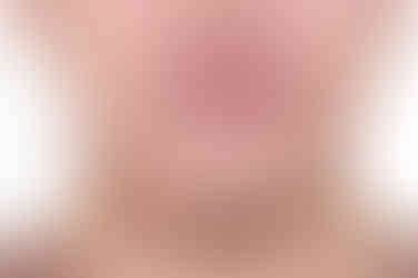 부산교정과전문의