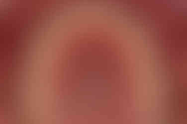 부산비발치교정