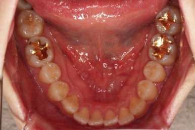 부산연산동치과