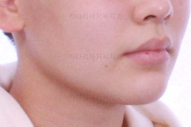 부산연산동치아교정