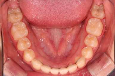 부산교정전문의