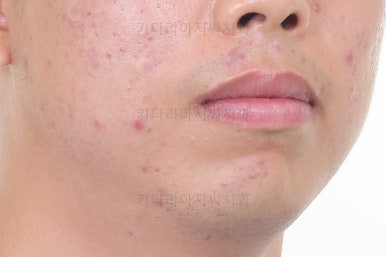 부산교정치과