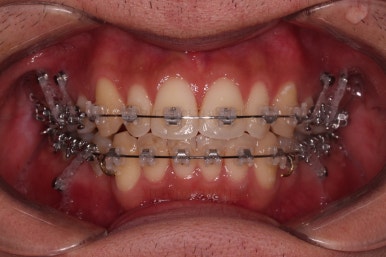 부산연제구교정