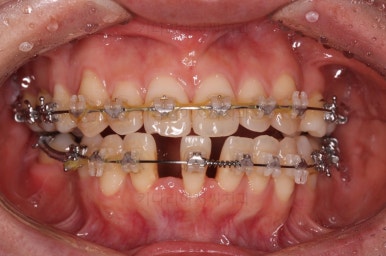 부산재교정치과