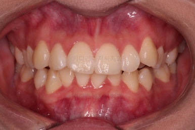 연산동치아교정치과