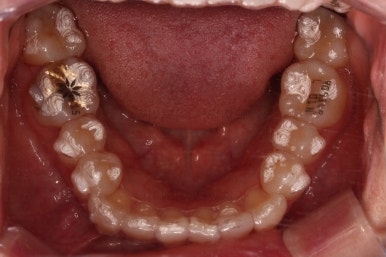 부산인비절라인