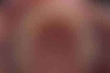 부산연산동교정치과