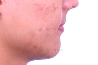 부산연산동치아교정