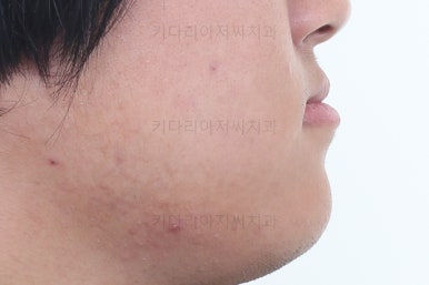 연산동교정
