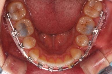 연산동교정치과