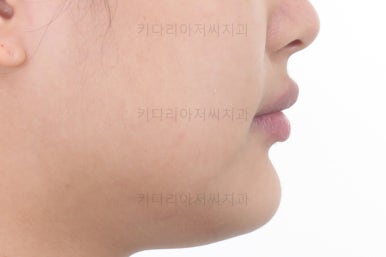 부산교정치과추천