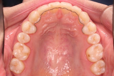 부산교정치과추천