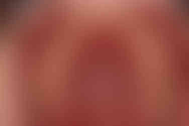 부산청소년치아교정