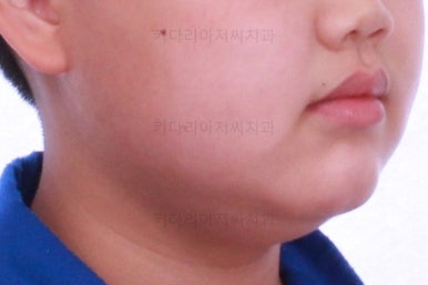 부산교정치과추천