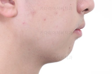 부산교정치과추천