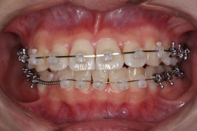 연산동교정치과