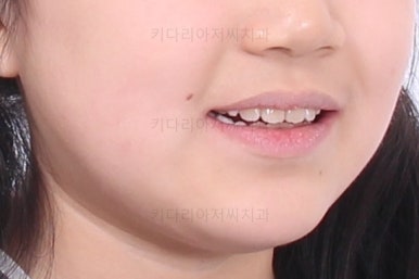 부산초등학생교정