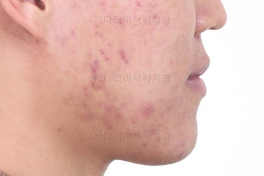 부산교정과전문의