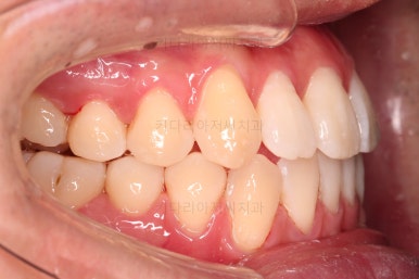 부산인비절라인