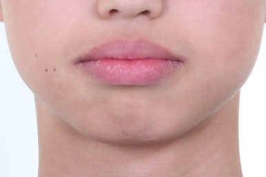 부산치아교정전문의