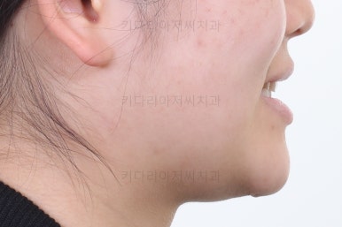 연산동교정치과