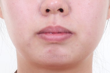 부산치아교정잘하는치과