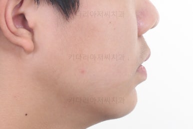 부산청소년교정