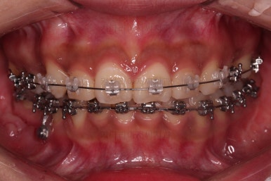 연산동교정치과