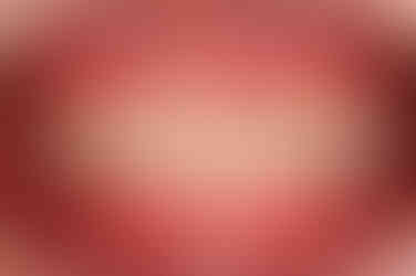 부산치아교정잘하는곳