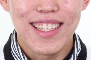부산교정과전문의