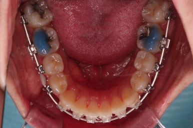 부산비대칭교정