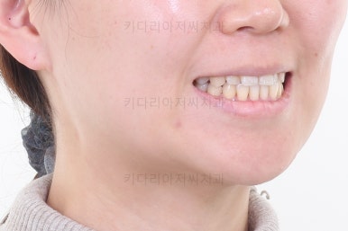 부산연산동치과