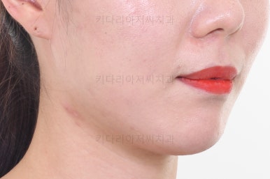 연산동교정치과