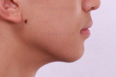 부산교정치과추천
