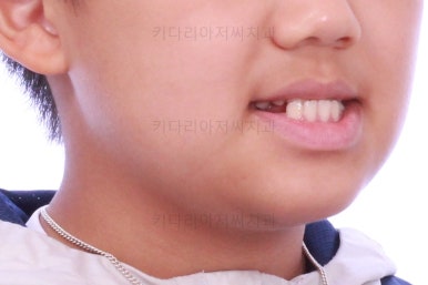 부산어린이교정