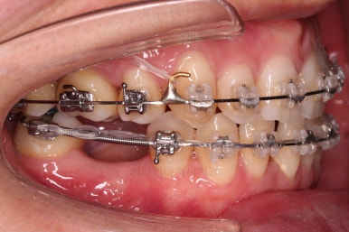 부산재교정치과