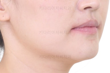 연산동교정치과